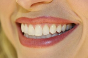 dental bridge